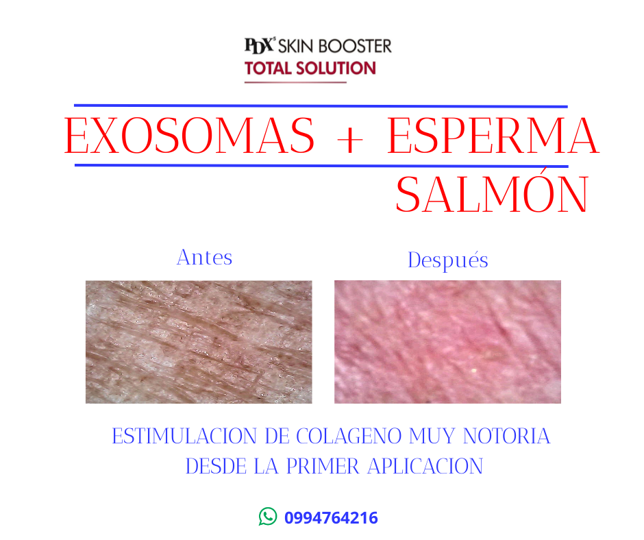 pdx exosomas esperma de salmon ecuador 9