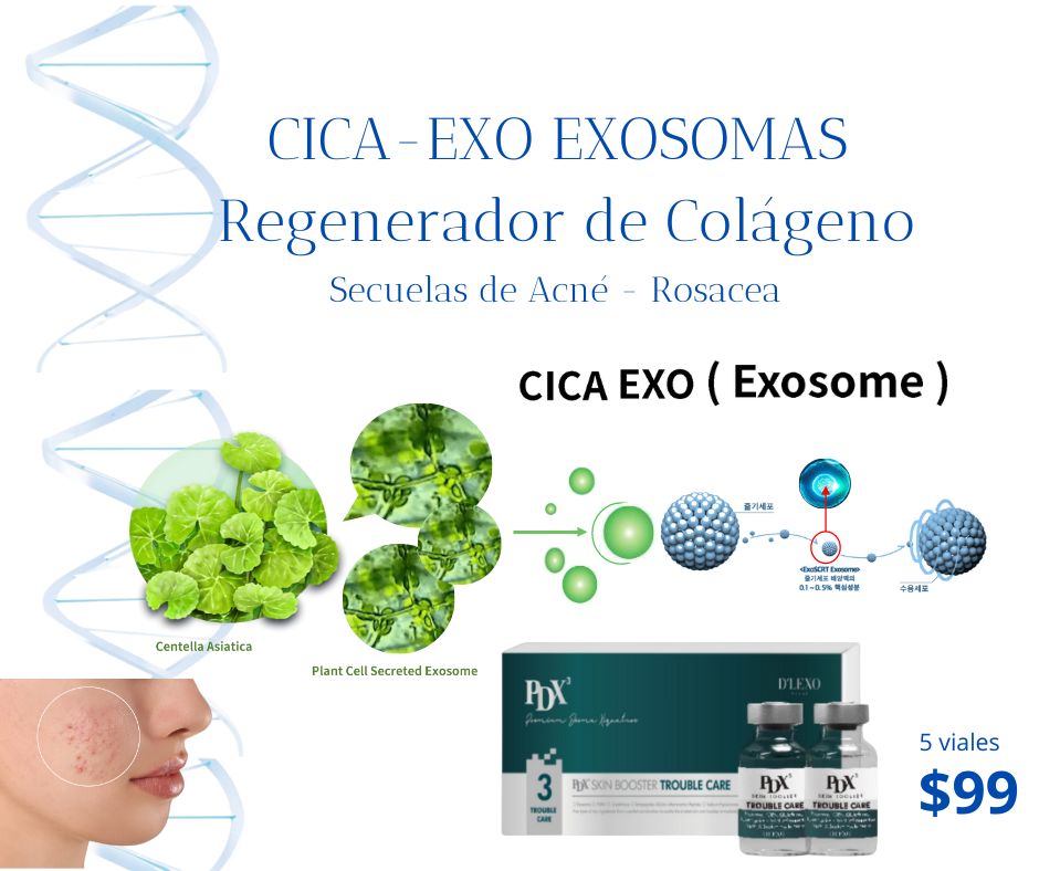 sculptra_hipla_radiesse_lenisna_acido_polilactico_hibrido_estimulador_colageno_940x788.png