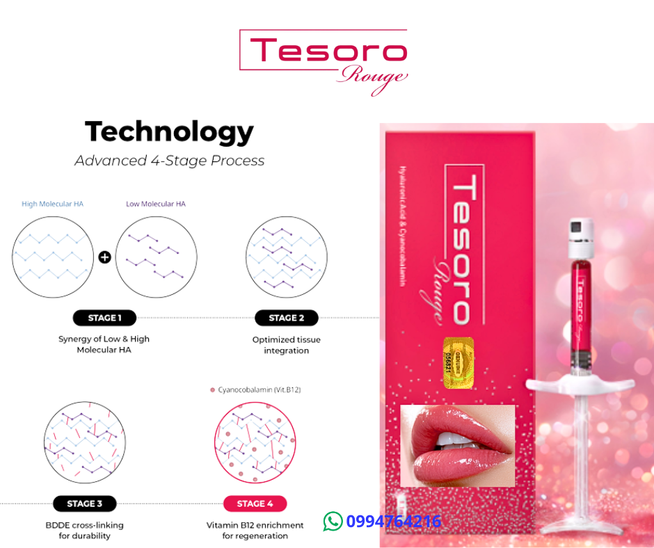 tesoro rojo rouge acido hialuronico para labios 7
