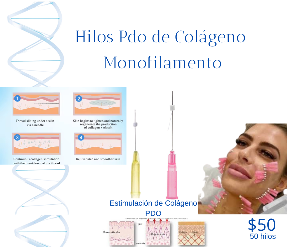 sculptra_hipla_radiesse_lenisna_acido_polilactico_hibrido_estimulador_colageno_940x788.png