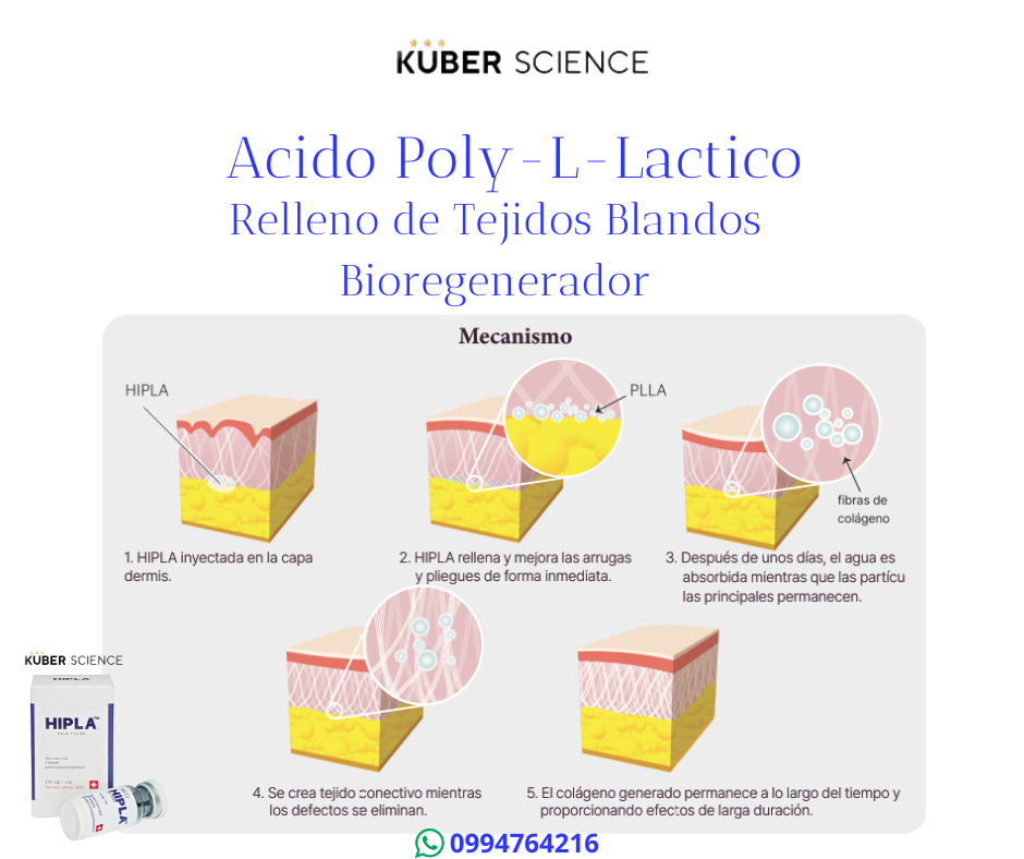sculptra radiesse hipla cahydra ecuador 10