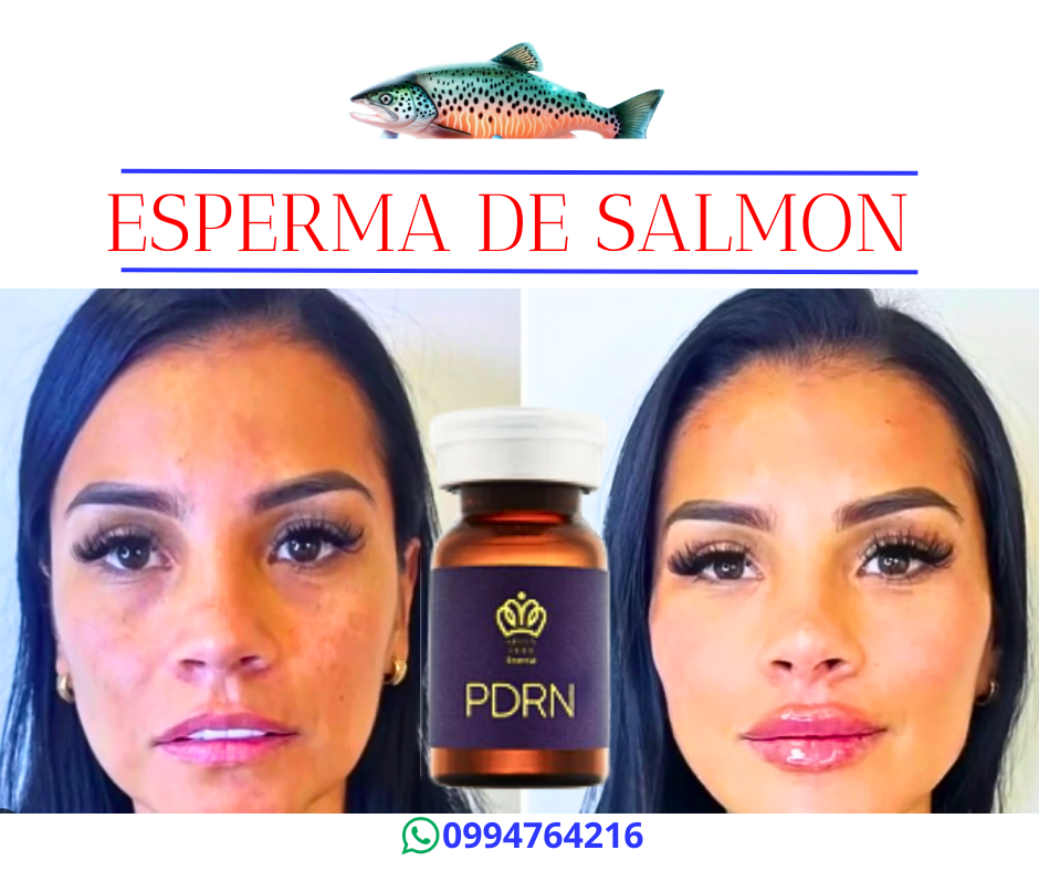 esperma de salmon pdrn adn la casa del estetico