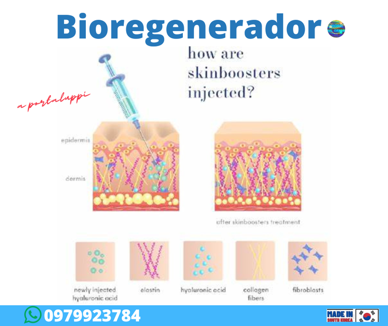 botox-portaluppi-otesaly-acido-hialuronico-hilos-colageno-espiculados-hafiller-dysport-skin-booster-toxina-botulinica-btxa-ojeras-ecuador-lima-peru-rellenos-nasogenianos-arrugas-odontologo-estetica-spa-cirugía-plastica-distribuidor-mayorista-cosmiatra-reage-xeomin-sculptra-kybella-quemadores-adelgazar-940x 788.png