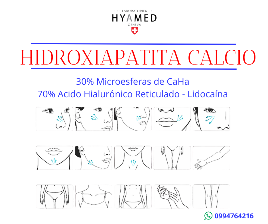 radiesse sulptra