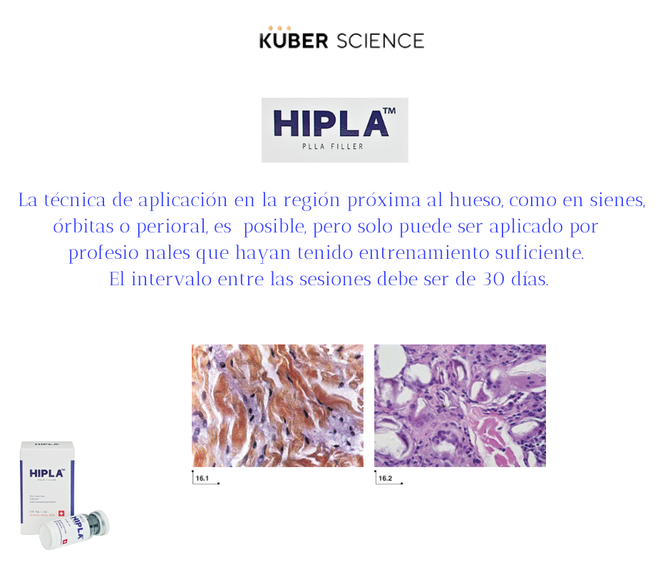 sculptra radiesse hipla cahydra ecuador 11