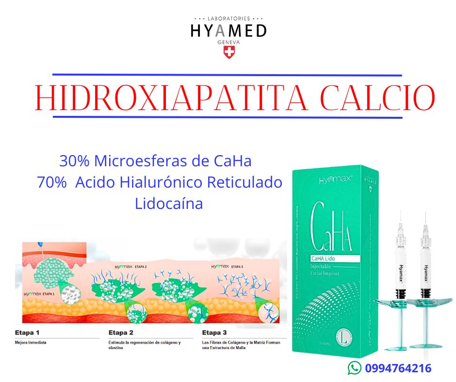 radiesse sulptra