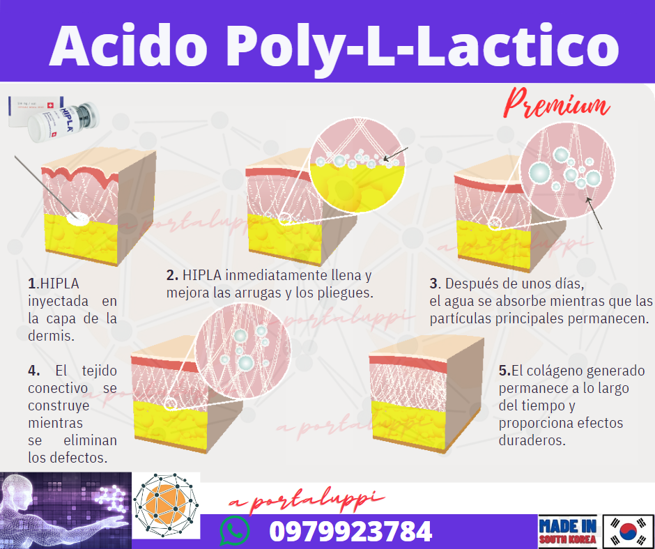 sculptra-hipla-plla-acido-poli-lactico-lapuroon-rejeunesse-liporase-enzimas-recombinantes-mccm-reductoras-exosomas-exoxe-7-940x788.png
