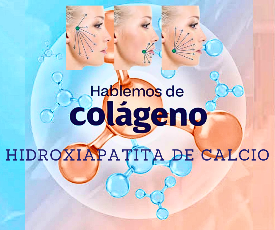 sculptra radiesse calhydra hyamax hidroxiapatita de calcio nad glutathione intravenoso 24
