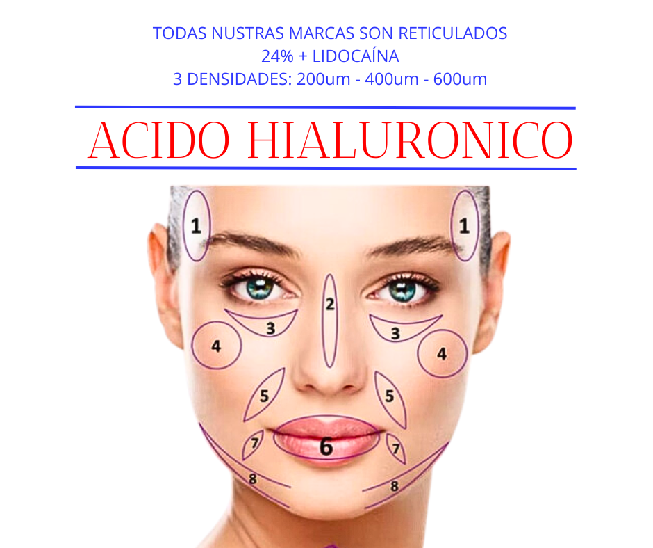 rejeunesse plenaris lexyal acido hialuronico reticulado 14