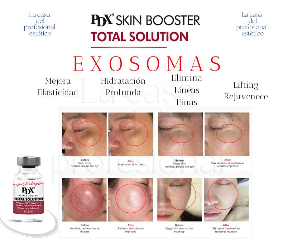 exosomas pdx5 bioregenerador skin booster total