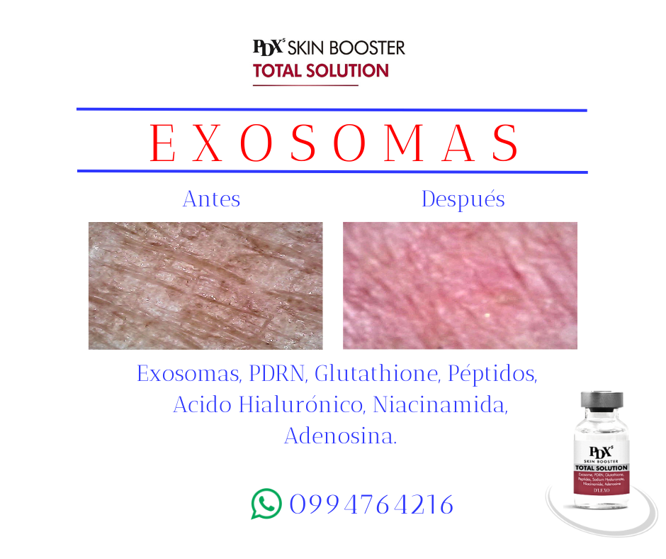 exosomas pdx total boost otesaly botox dyport lapuroon nctf nad glutathione intravenoso 26