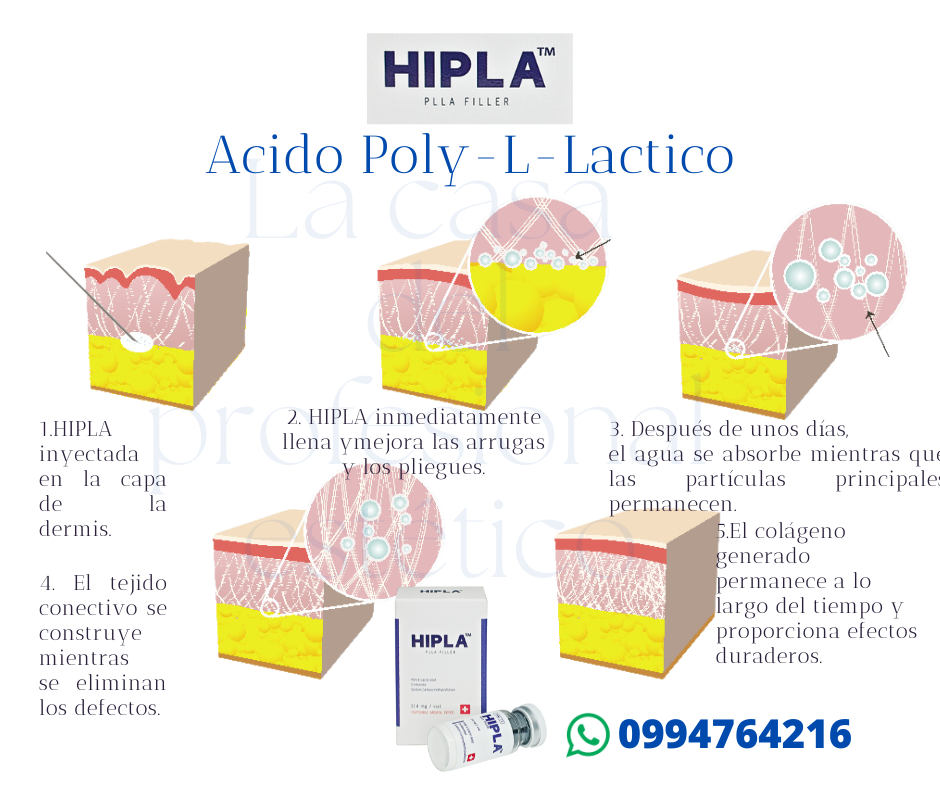 sculptra acido polilactico hipla
