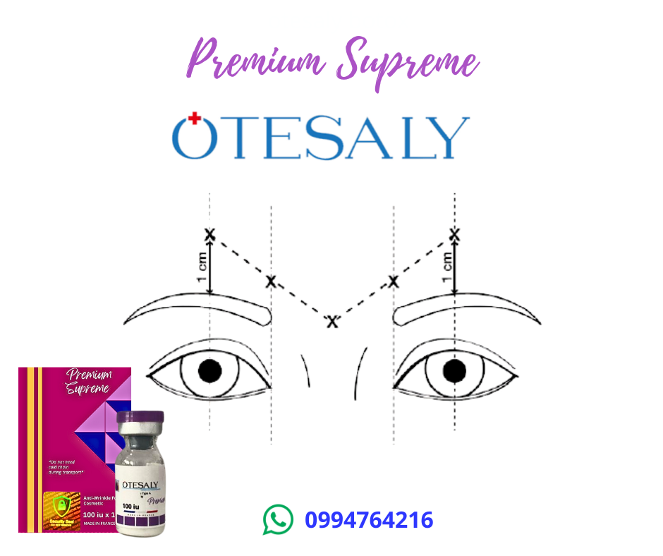 otesaly
