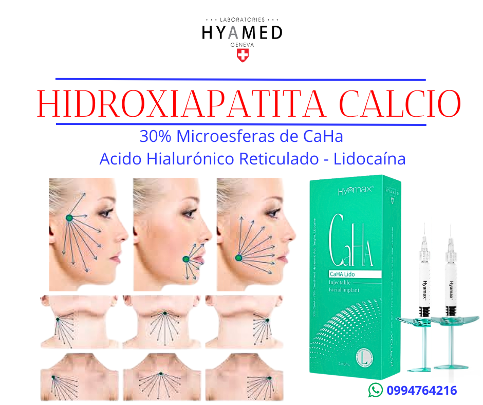 radiesse sulptra